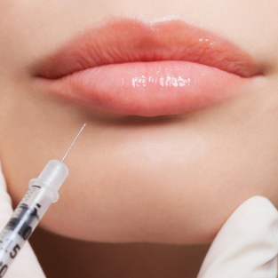 Juvederm Volbella half syringe