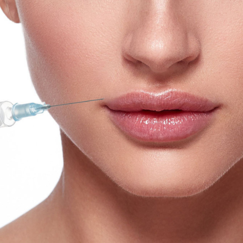 Juvederm Ultra XC/Ultra Plus