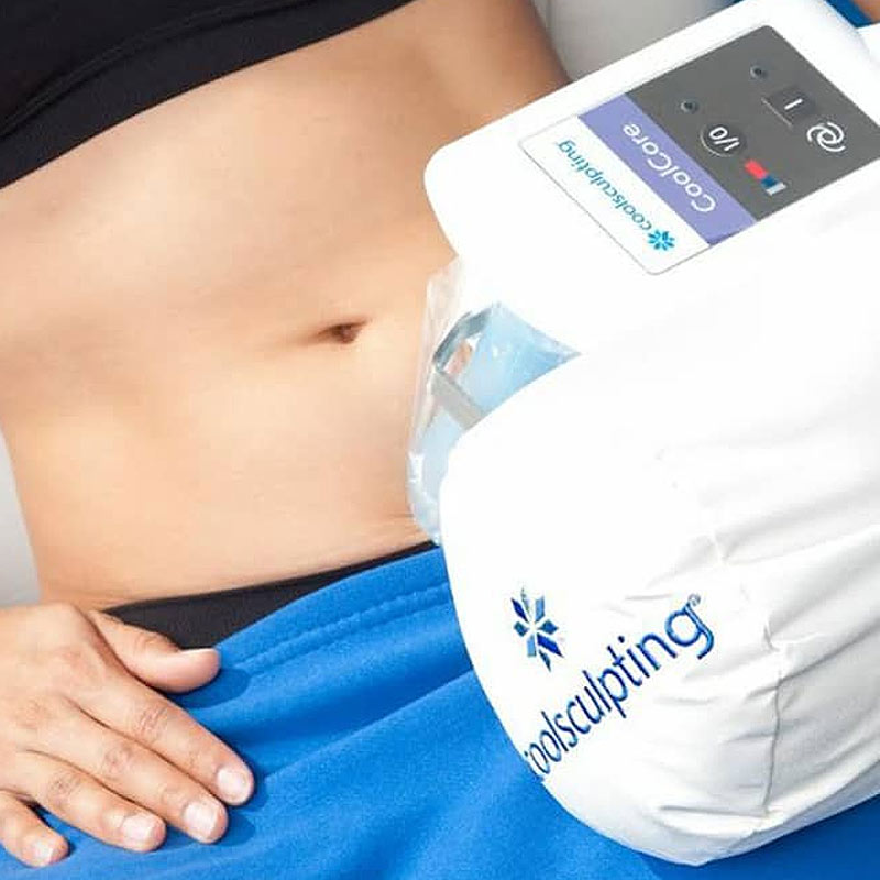 CoolSculpting